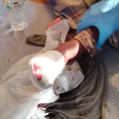 CHHs injury treatment